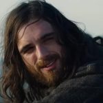 Джейкоб Элорди рассказал об ожоге второй степени